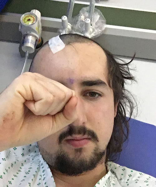 Billy describes the treatment he received as excellent 