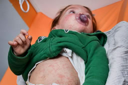 Renewed Vaccination Call in Hammersmith & Fulham